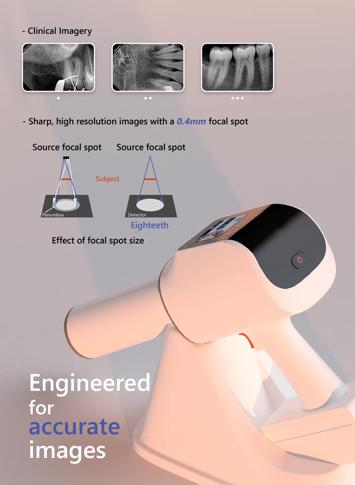 HyperLight Portable X-Ray